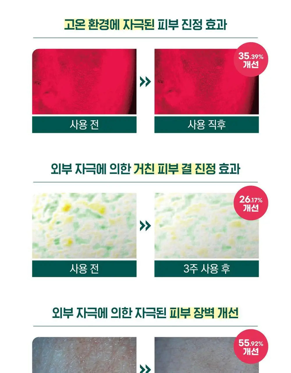 [더블기획/트러블쏙] 라운드랩 소나무 진정 시카 앰플 30ml 리필기획 (+30ml 리필+마스크+스티커 모음) 상세페이지 18